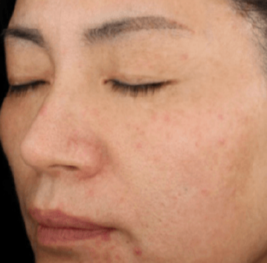 Before/After Image